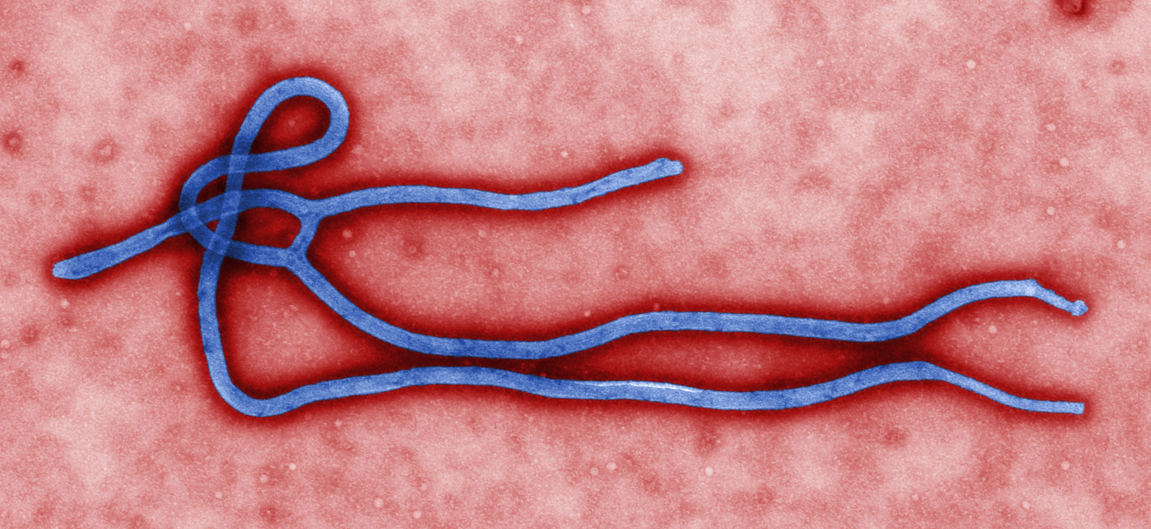 Bacilliform filamentous virus particles